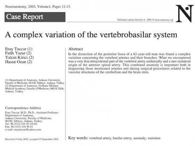 A complex variation of the vertebrobasilar system