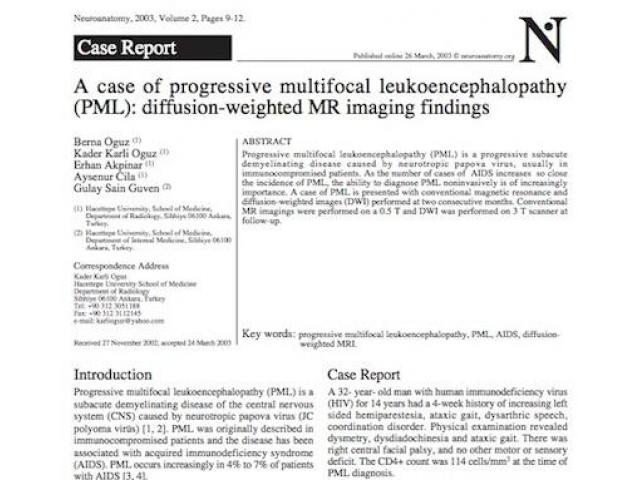 A case of progressive multifocal leukoencephalopathy (PML): diffusion - weighted MR imaging findings